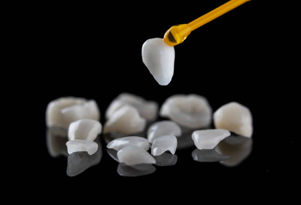 Dental ceramic veneers on the black background