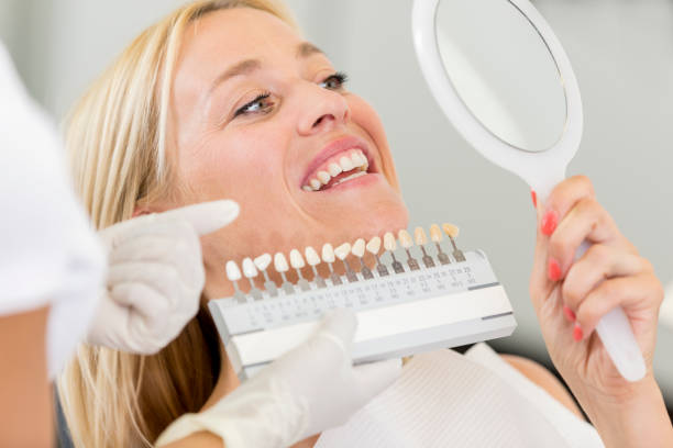 veneers_4