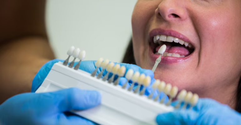 Best full mouth rehabilitation (12)