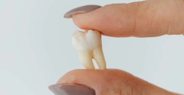 Best full mouth rehabilitation (17)