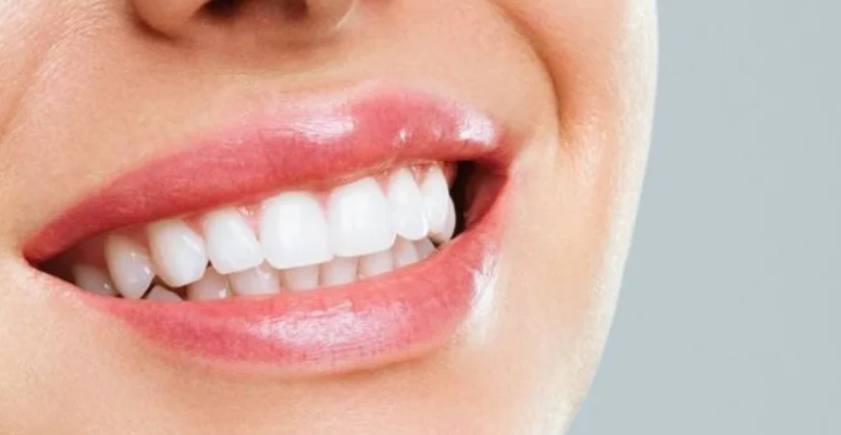 Best full mouth rehabilitation (2)