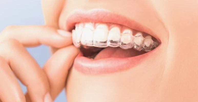 Best full mouth rehabilitation (22)