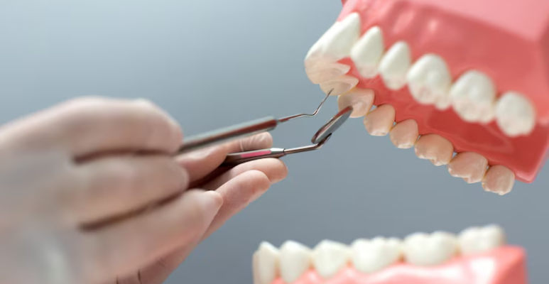Best full mouth rehabilitation (5)